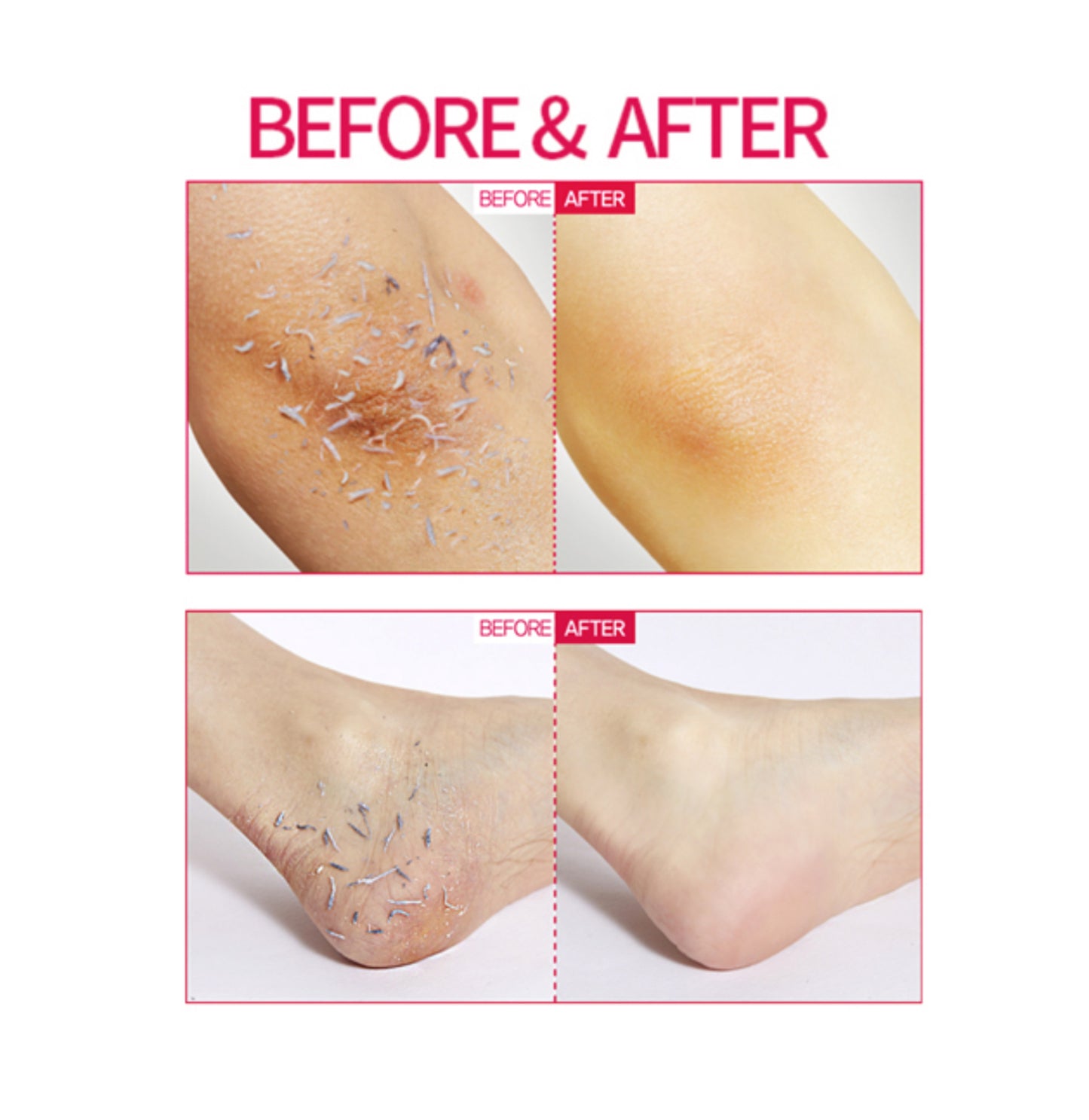 ENPRANI BODY PEELING