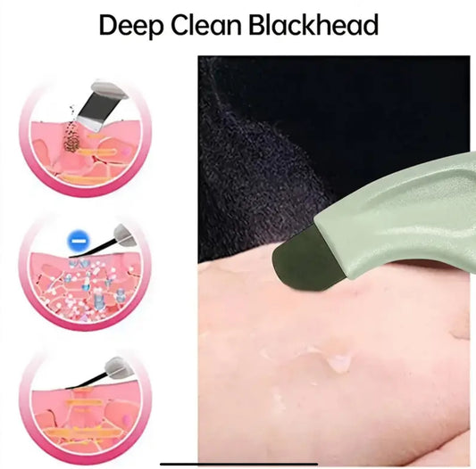Blackhead Remover Tool